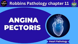 Angina PectorisRobbins Pathology 11Pathology lecturesHeart pathology pathology robbins heart [upl. by Fortuna]