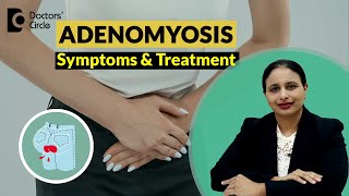 Heavy Painful Periods Adenomyosis of UterusSymptoms amp Treatment DrRashmi Yogish Doctors Circle [upl. by Acillegna587]