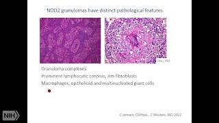 Monogenic Granulomatous Inflammatory Diseases [upl. by Eiramalegna]