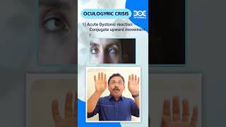 QuickLearningByte  OCULOGYRIC CRISIS  MEDICINE  DR RAHUL RAJEEV  DOCTUTORIALS [upl. by Ellainad994]