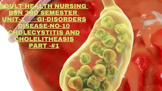 AdulHealthNursing BSN3rd semester Unitl GIDisorders Disease No10 Cholecystitis and cholelithiasis [upl. by Fanni979]