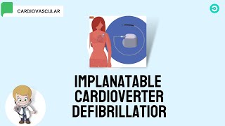 ICD Implantable Cardioverter Defibrillator [upl. by Leuams70]