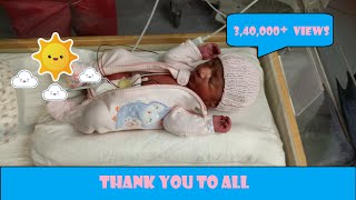 My Baby Born at 35 Weeks Premature Birth [upl. by Cariotta807]