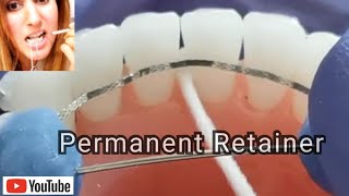 How to Clean Permanent Retainers Tips amp Easy Tricks [upl. by Alejandra]