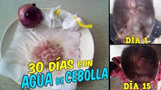 Usando CEBOLLA 1 Mes en el Cabello  Detiene la Caída  Cabello Fuerte y Largo [upl. by Marbut]