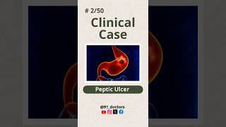 Severe Stomach Pain Know the Real Cause Behind Peptic Ulcers shorts youtubeshorts viralvideo [upl. by Chip]