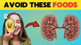 These 8 Foods Are Silently Destroying Your Diseased Kidneys [upl. by Olegna323]