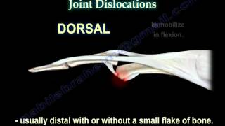 Dislocations Of The Finger  Everything You Need To Know  Dr Nabil Ebraheim [upl. by Robinia]