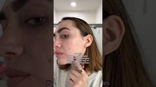 The BEST hack for after popping pimples  acne pimples pimplepopping beautyhacks acnetips [upl. by Sirraf]