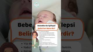 Bebeklerde Epilepsi Belirtileri Nelerdir [upl. by Ydnys]