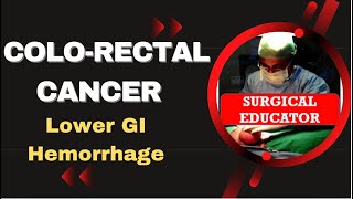 COLORECTAL CARCINOMA How To DIAGNOSE amp TREAT Lower GI Hemorrhage [upl. by Eillit573]