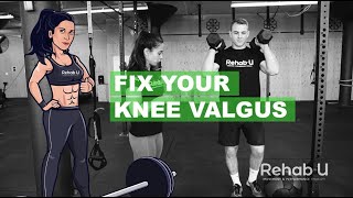 The Real Fix For Knee Valgus [upl. by Nareht]