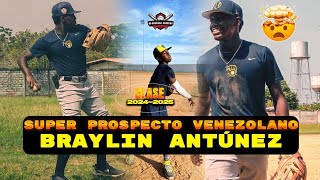 UNO DE LOS MEJORES PROSPECTOS VENEZOLANOS PARA EL 15 DE ENERO DEL 2025 BRAYLIN ANTUNEZ [upl. by Macrae]