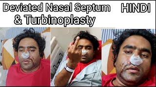 Deviated Septum Surgery  DNS  Septoplasty amp Turbinoplasty  Septoplasty Vlog In Hindi [upl. by Nyrrat231]