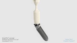 SmartFix concept Astra Tech Implant System EV Multibase Abutment EV 30  Dentsply Sirona [upl. by Ykroc246]