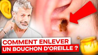 Comment Enlever un Bouchon de Cérumen  huile dolive bougies 😮 [upl. by Trenna759]