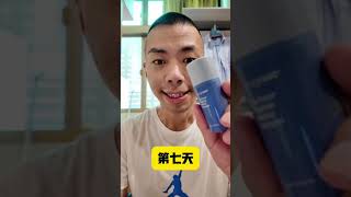 Nuskin 奇蹟霜七天實測，真的能改善痘疤嗎？實測 痘疤 成長型思維 [upl. by Weiner284]