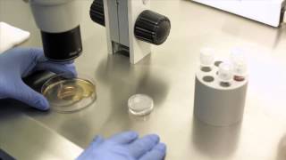 IVF  IN VITRO FERTILIZATION [upl. by Witte269]