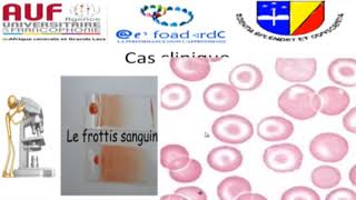 MORPHOLOGIE EN HEMATOLOGIE EPISODE 4 [upl. by Airdnahc559]