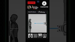 How to do Chest XRay PA view  XRay Positioning radiology xray positioning shorts chest [upl. by Aicertal574]