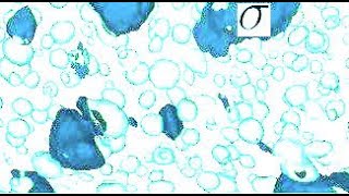 Sigmaphase in alloys of iron crystal and microstructure [upl. by Anaihs992]