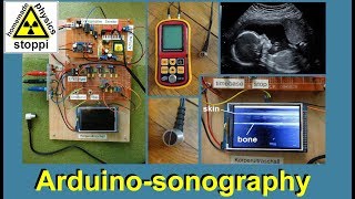 ultrasonic body sonography with arduino  part 2 [upl. by Noicpesnoc]