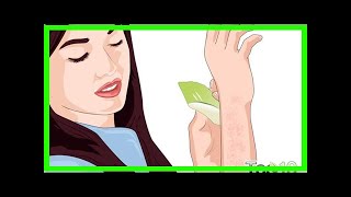 How to Get Rid of Bumps on Arms [upl. by Aronoff974]