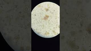 WhipwormTrichuris vulpis egg in dogs dogs parasite worms [upl. by Ydnih]