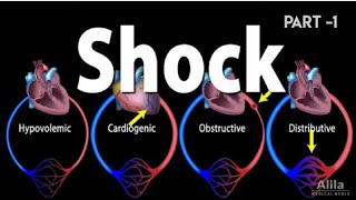 Shock  Part 1  Pathology  Harsh Mohan [upl. by Magnus461]