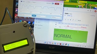 EMG BIOSENSOR BY USING ESP32 WITH IOT APPLICATION FOR ATHLETES [upl. by Nuy241]