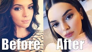 Kendall Jenner TOTALLY Just Got Plastic Surgery She Looks Completely Different [upl. by Wootan]