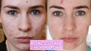 2 MONTH ROACCUTANE UPDATE  Side effects amp my skin now [upl. by Anaiviv47]