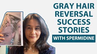 Gray Hair Reversal Success Stories with Spermidine [upl. by Lindy]