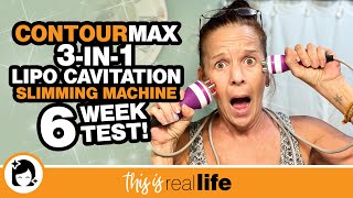 ContourMax 3in1 Lipo Cavitation Slimming Machine 6 Week Test  THIS IS REAL LIFE [upl. by Lesna]