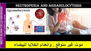 Lecture 23 Neutropenia and Agranulocytosis [upl. by Colline891]