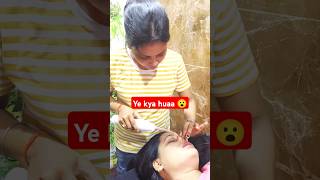 Pimple removal treatment 😮 shorts ytshotsmehndi [upl. by Grimona]