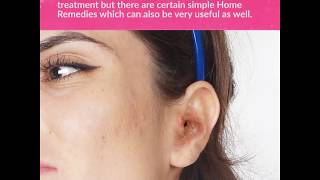 6 Effective Home Remedies to Get Rid of Swimmers Ear [upl. by Stargell123]