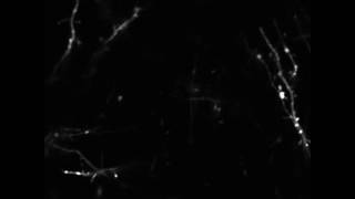 Dendrites and dendritic spines in the mouse cortex [upl. by Aaronson120]