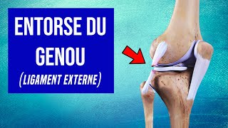 Entorse du genou Ligament Externe  Les Traitements [upl. by Eiraminot943]