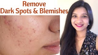 Remove Acne spots dark spots amp blemishes in Hindi  100 natural face mask to get even skin tone [upl. by Emmeline]