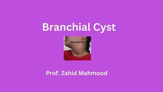 Branchial Cyst by Prof Zahid Mahmood [upl. by Eniar]