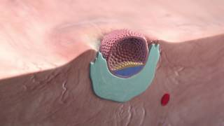 Implantation of the blastocyst [upl. by Bez]