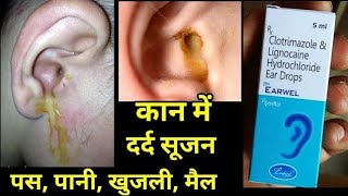 Earwel Ear Drops uses side effects in hindi earwel ear drop use hindi [upl. by Trbor]