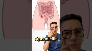 Síntomas de alerta de apendicitis que no debes ignorar  Dr William Guerrero medicina shorts [upl. by Aiz]