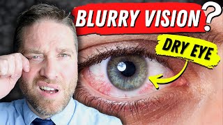 Why Dry Eyes Cause Blurry Vision  3 Reasons And 3 Home Remedies [upl. by Yauqaj]