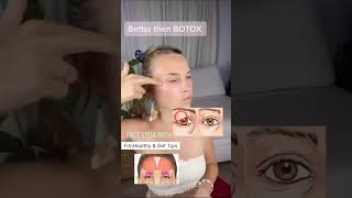 Eyelid exercise  Droopy eyelid massage  eyelid droopyeyelids [upl. by Thornton154]