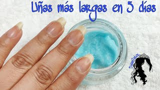 Como hacer crecer las Uñas en 5 días con tres ingredientes Eliminar hongos usando sal [upl. by Tram]