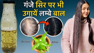 सबसे Powerful Hair Growth Oil to REGROW LOST HAIR  खोये हुए बालों को वापस उगाने सबसे अचूक तरीका [upl. by Hunsinger65]