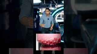 ஆணுறுப்புக்குள் சிறு பருக்களா Pearly penile papules Dr Isacc Abbas [upl. by Lorusso]