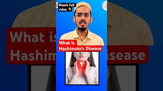 What is hashimotos disease  shorts hashimotos thyroidproblems [upl. by Nabala]